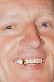 Un homme avec une dent en or sur le Meidlinger Markt