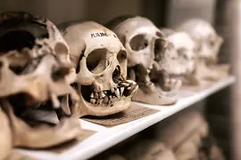 Colección de Anatomía Patológica en la Torre de los Locos