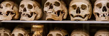 Collection d'Anatomie pathologique dans la Tour aux fous