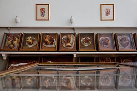 Vista della mostra con modelli anatomici in cera nelle vetrine d’epoca