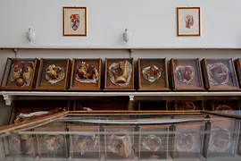 Ausstellungsansicht mit Wachsmodellen in historischen Vitrinen