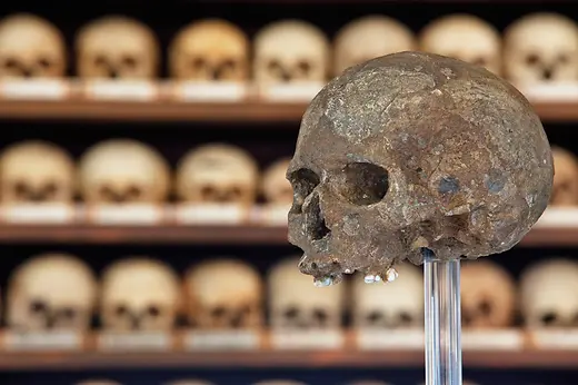 Skull